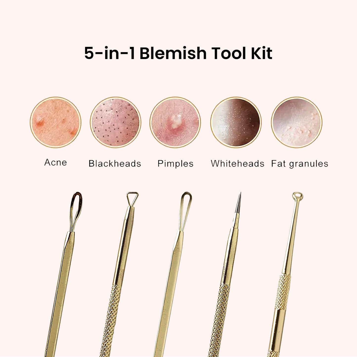 Blemish Tool Kit (Blackhead Remover)